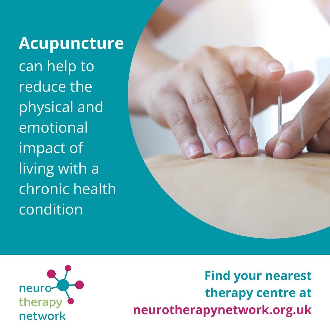 10-16 Nov is #AcupunctureAwarenessWeek. This fine needle treatment from ancient Chinese medicine works by stimulating nerves to release the body’s natural painkillers and enhance wellness. Visit our website to find a therapy centre that offers #acupuncture neurotherapynetwork.org.uk