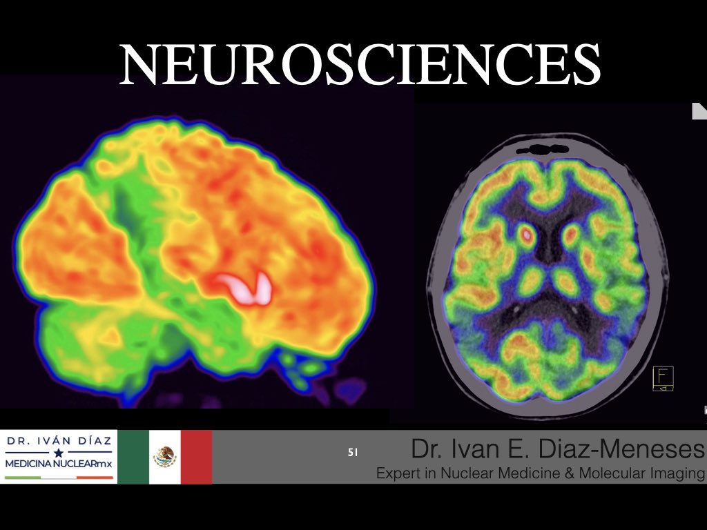 IvanDiazMeneses's tweet image. ✨ #Molecularimaging &amp;amp; #nuclearmedicine are medical specialties with a strong economy and a bright future. ✨
💪🏼Empowering nuclear medicine physicians 🧑‍⚕️👨🏻‍⚕️means increasing their participation in wealth creation and the development of healthcare markets.