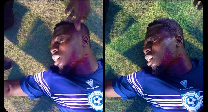 ALARMINGAFRICA's tweet photo. Sad News! Africa to Africa in a football pitch, Katsina United fans invaded the football field and slit a Player Mana Abraham from Barau FC after qualifying to 1:1 to Katsina United. https://t.co/WUrteTV0NC