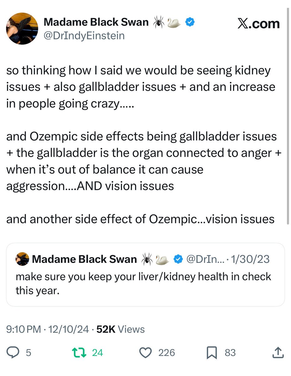 yep. people tried to get mad at me when I said this but it’s true. hope you’re feeling better.