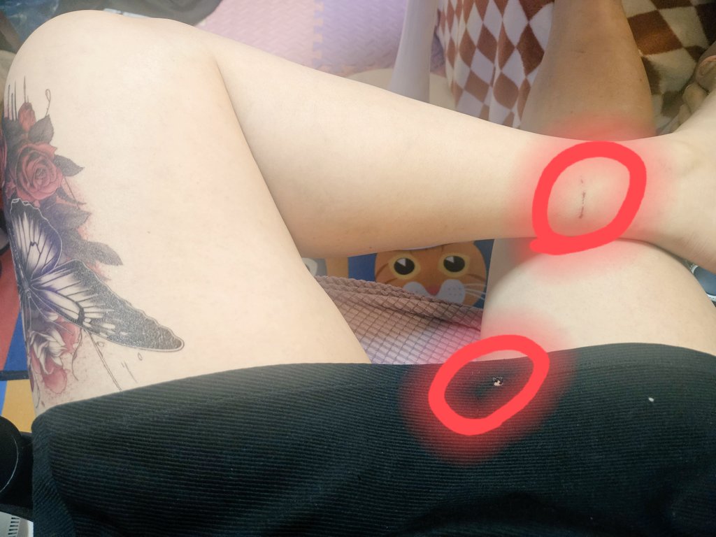 다리는 어디서 긁힌거야...
치마 에 담배 불똥이 언제 떨어졌지?