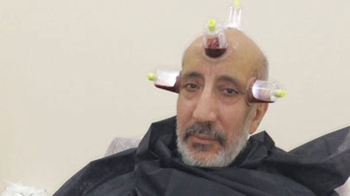 Kansız hacamat ve Tayvan Sokak Yemekleri ve Taipei Geceleri 🇹🇼 youtu.be/TASYGJ3ApBQ?si… 
<a href="/ifkoparan/">Fatih Koparan</a> aracılığıyla