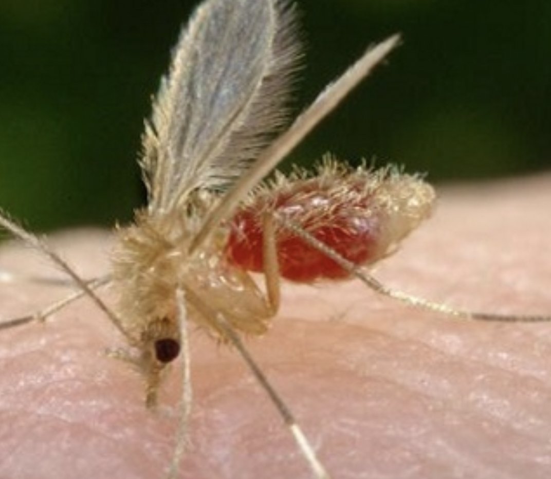 USMLEStepStudy's tweet image. Leishmaniasis: parasitic dz spread by sand fly bites 🦟
▶️ Cutaneous: Skin ulcers at bite site (MC)
▶️ Mucocutaneous: mouth/nose mucous membranes
▶️ Visceral: Fever, wt loss, splenomegaly, hepatomegaly
Rx: 💊 Antiparasitic liposomal amphotericin B