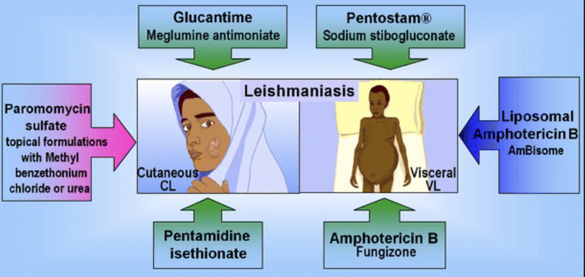 USMLEStepStudy's tweet image. Leishmaniasis: parasitic dz spread by sand fly bites 🦟
▶️ Cutaneous: Skin ulcers at bite site (MC)
▶️ Mucocutaneous: mouth/nose mucous membranes
▶️ Visceral: Fever, wt loss, splenomegaly, hepatomegaly
Rx: 💊 Antiparasitic liposomal amphotericin B