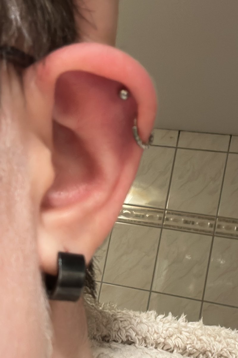 Ich hab mich gefragt warum mein Piercing immer weh tut. Hab es gewechselt und was seh ich da… halbes Loch ist zu und komplett blutig. Dank diesem Helix hatte ich seit fast 2 Wochen Ohrenschmerzen. Wenigens konnte ich es wechseln und jetzt nochmal heilen lassen😭