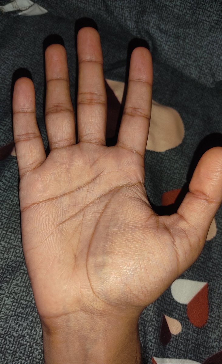 vedantdotrpm's tweet image. anyone out there can read my hands?