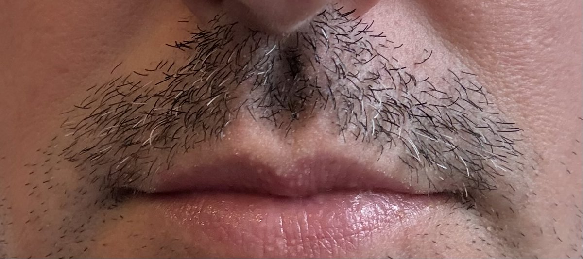 Day 9 of #NoShaveNovember