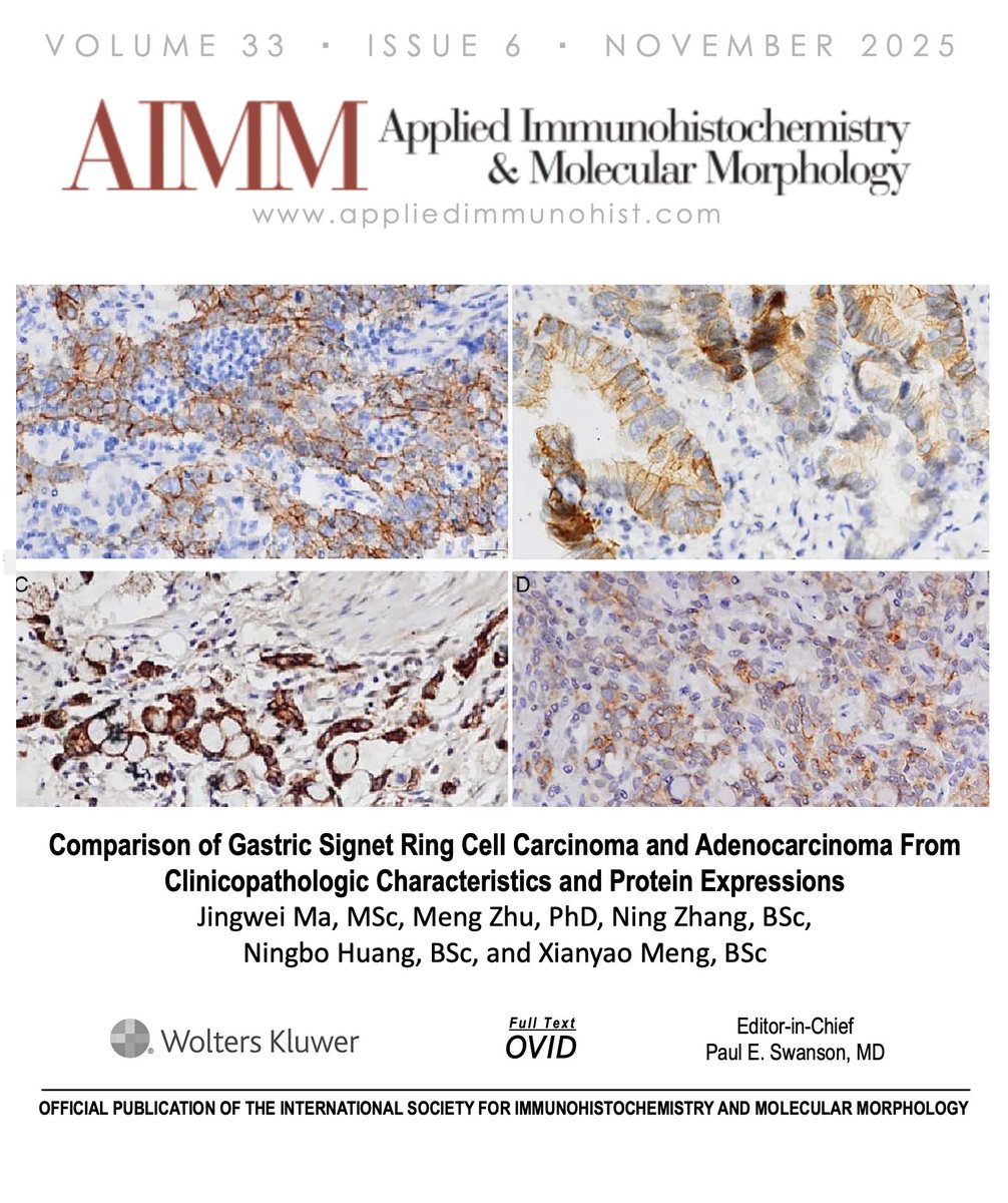 Check out our Current Issue!!  

Figure from "Comparison of Gastric Signet Ring Cell Carcinoma and Adenocarcinoma From Clinicopathologic Characteristics and Protein Expressions” by Ma, et al. 

🔗 Read the full article here: journals.lww.com/appliedimmunoh…