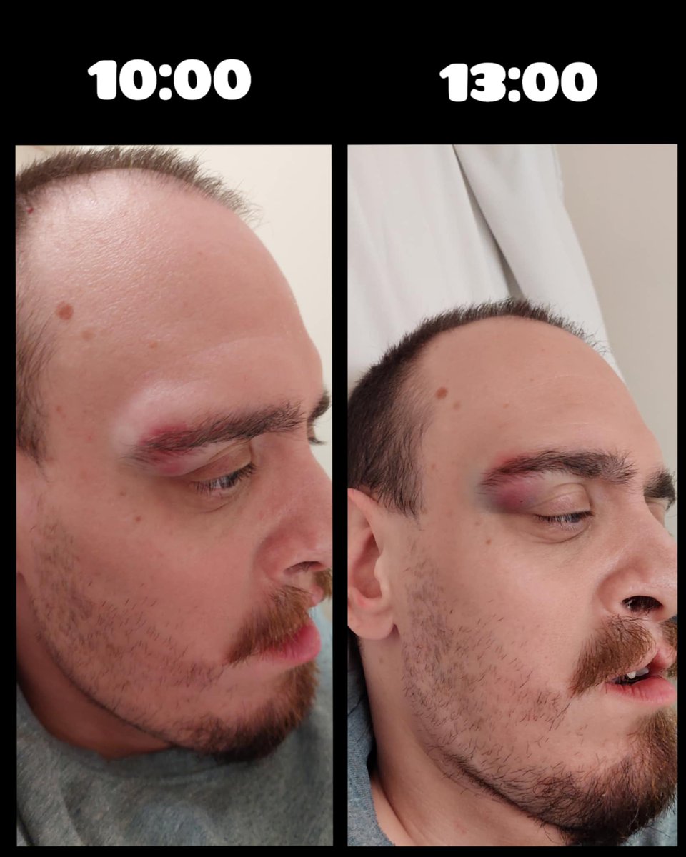 Josh Stephen tweet media