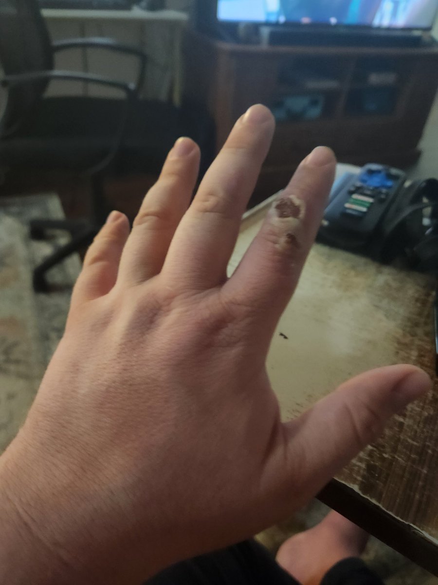 SingleDude77's tweet image. Here's a great reason for me never to cook again.

#Darealpatrickp