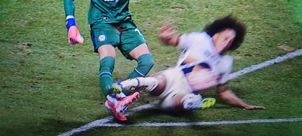 Con la fractura de Mier de <a href="/CruzAzul/">CRUZ AZUL</a> la comisión de árbitros deben sacar los audios y explicar por qué tardo tanto el VAR en intervenir, por qué no le mostraron al arbitro  las tomas correctas y por qué llegaron a la conclusión arbitro y VAR que la brutal entrada de Carrasquilla