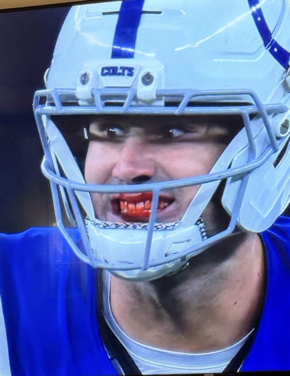 "Sorry babe, I'm on my period..."

Me: