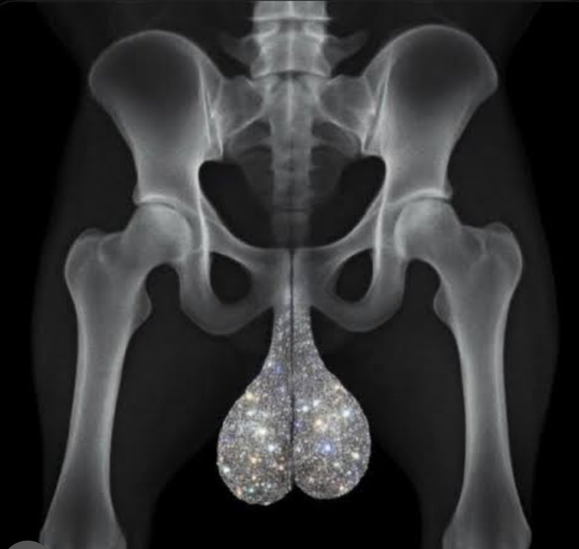 @RizzgivinV2 Lfg🔥only diamonds balls