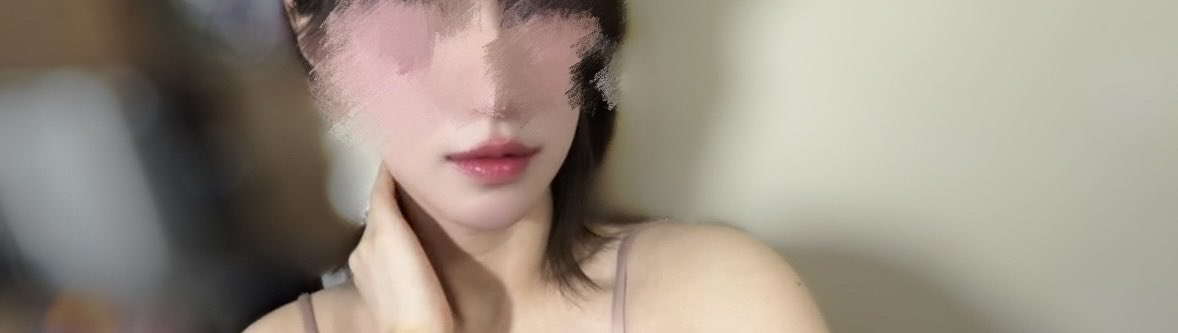 mamushiken's tweet photo. ドクタータク💋で
・内側人中短縮
・外側人中短縮
・口角挙上
・Cカール
・上���カーテン除去

5ヶ月たちました🔍笑顔も写真通りでもう術前と同じくらい笑えます✨✨
口元フルして顔面偏差値爆上がりした🎶
可愛くなったって言われるから嬉しい♡ https://t.co/h1vtQ9QAFI