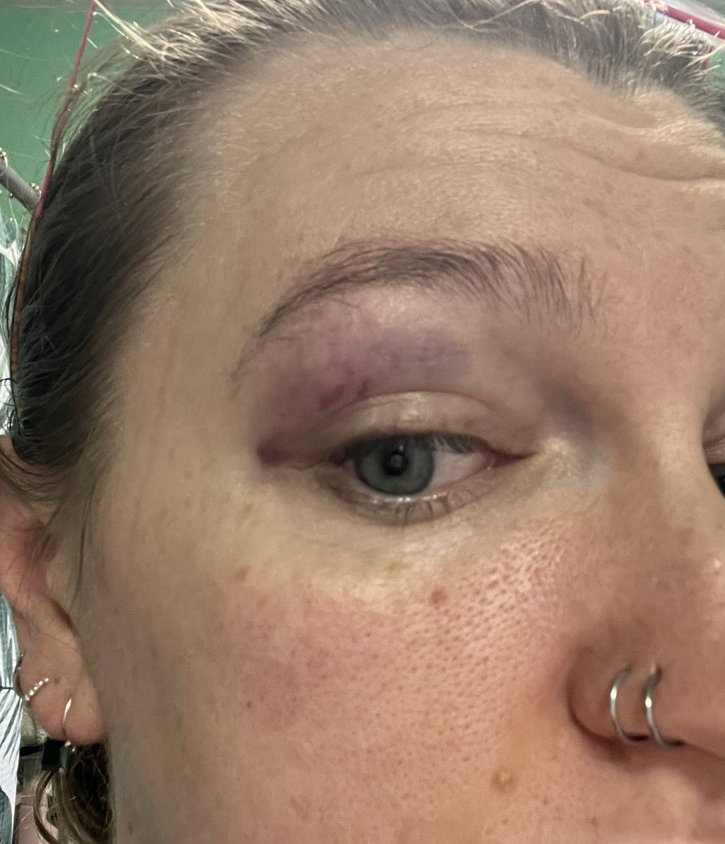 liz ❤️‍🔥 tweet media