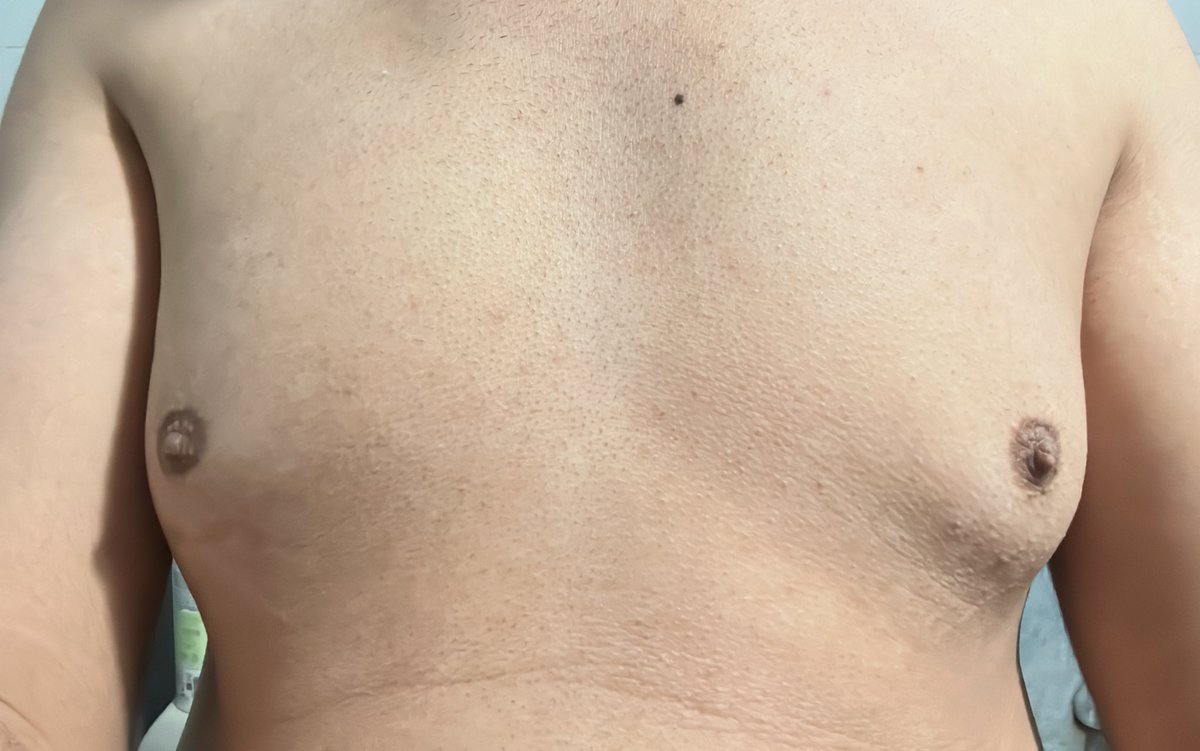 شنو رايكم بصدري 🫦👅🫠