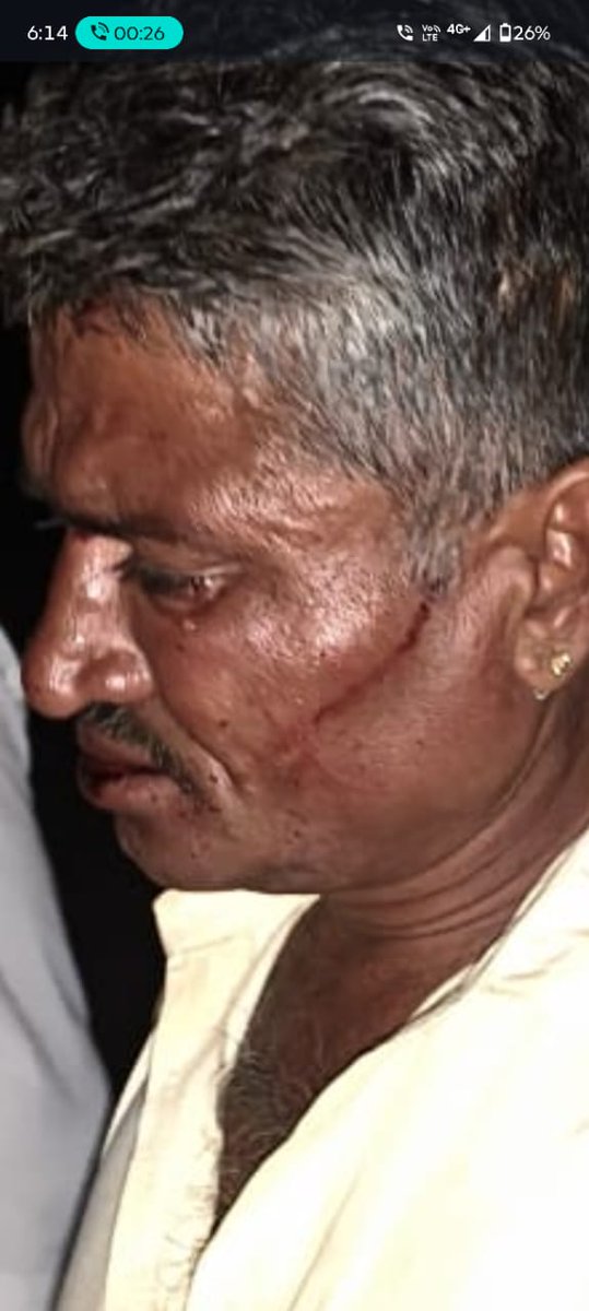 im_chains_boudh's tweet image. #बाड़मेर 
गिराब थाने का मामला जहां सामंतवादी सोच के लोगों ने एक दलित व्यक्ति के साथ बेरहमी से मारपीट कि गयी,
जिसमें अभी तक कोई गिरफ्तारी नहीं हुई है,
@Barmer_Police @RajPoliceHelp से निवेदन है कि तुरंत प्रभाव से दोषियों पर कार्यवाही कर गिरफ्तार करें,
@BhimArmyChief
@anil_aazad