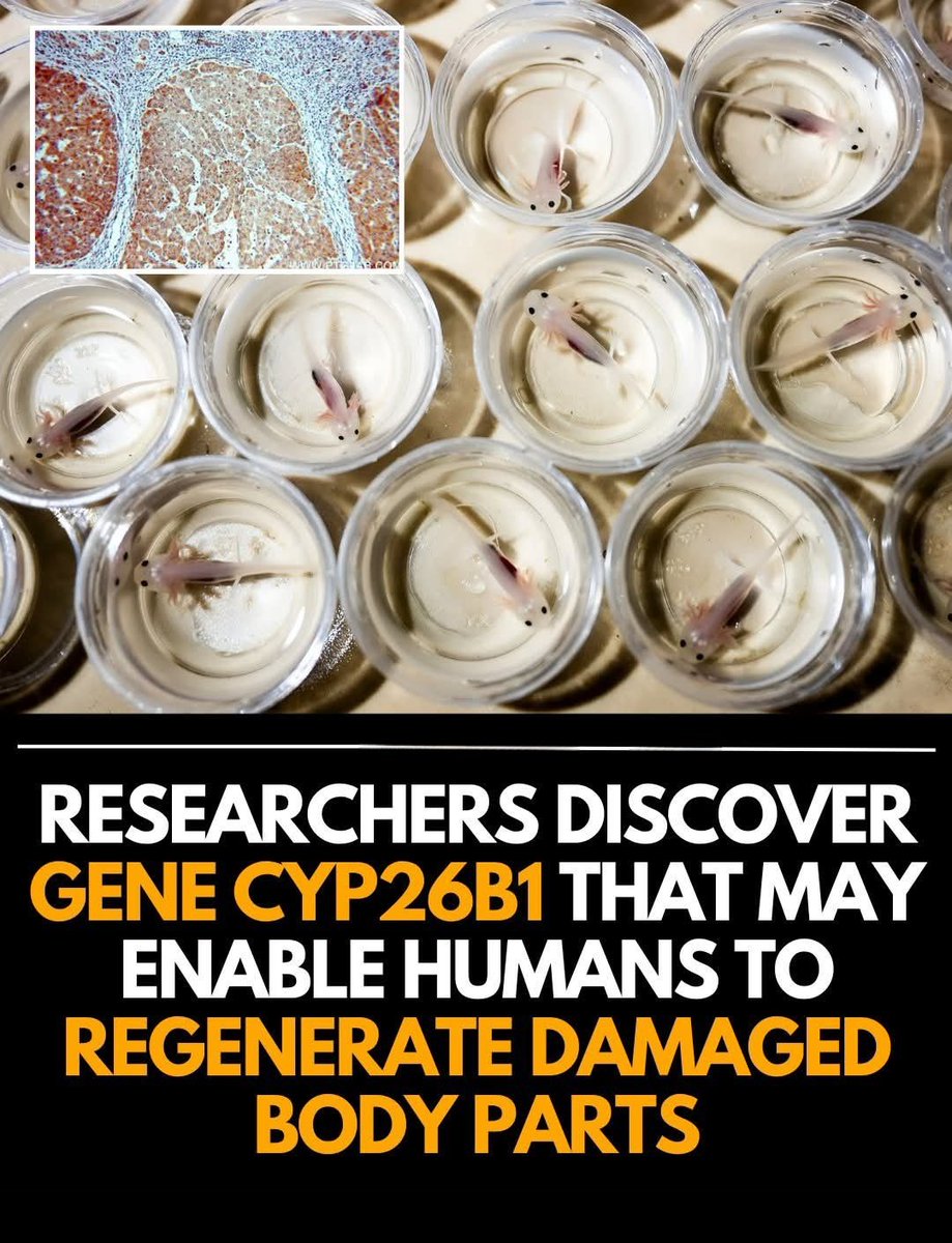 ShiningScience's tweet image. 🧬 Scientists May Have Found the Gene That Could Let Humans Regrow Body Parts

Imagine if a cut, a broken bone — or even a damaged organ — could grow back perfectly on its own. No surgeries. No transplants. Just your body healing itself… the way nature intended.

Scientists have…