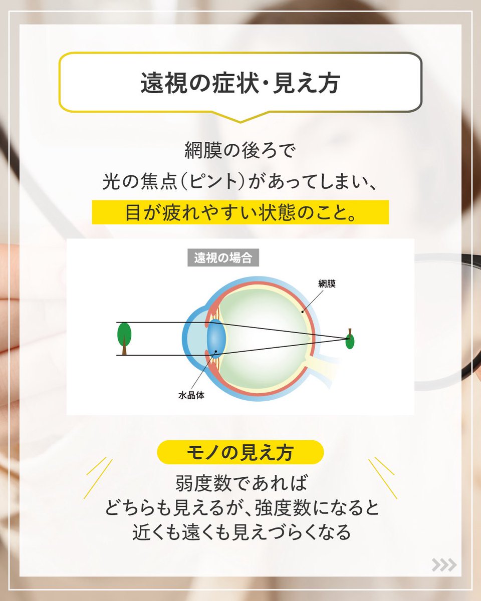 fujitafuji5100's tweet image. 知ってるようで知らない‼️
“近視”と“遠視”のちがい。

🔹 近視
✓ 近くははっきり見える
✓ 遠くはぼやける

🔹 遠視
✓ 度数が弱ければ近くも遠くも見える
✓ 度数が強ければ近くも遠くも見えづらいなる

自分の目の特性を知ることが、毎日の快適な視界の第一歩です✨

  #目の雑学 #目の健康