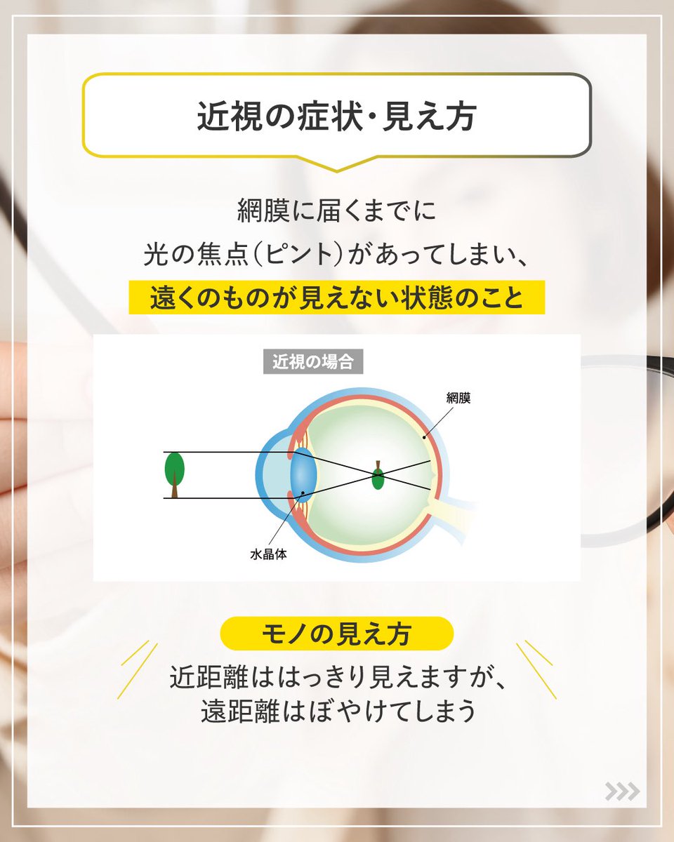 fujitafuji5100's tweet image. 知ってるようで知らない‼️
“近視”と“遠視”のちがい。

🔹 近視
✓ 近くははっきり見える
✓ 遠くはぼやける

🔹 遠視
✓ 度数が弱ければ近くも遠くも見える
✓ 度数が強ければ近くも遠くも見えづらいなる

自分の目の特性を知ることが、毎日の快適な視界の第一歩です✨

  #目の雑学 #目の健康