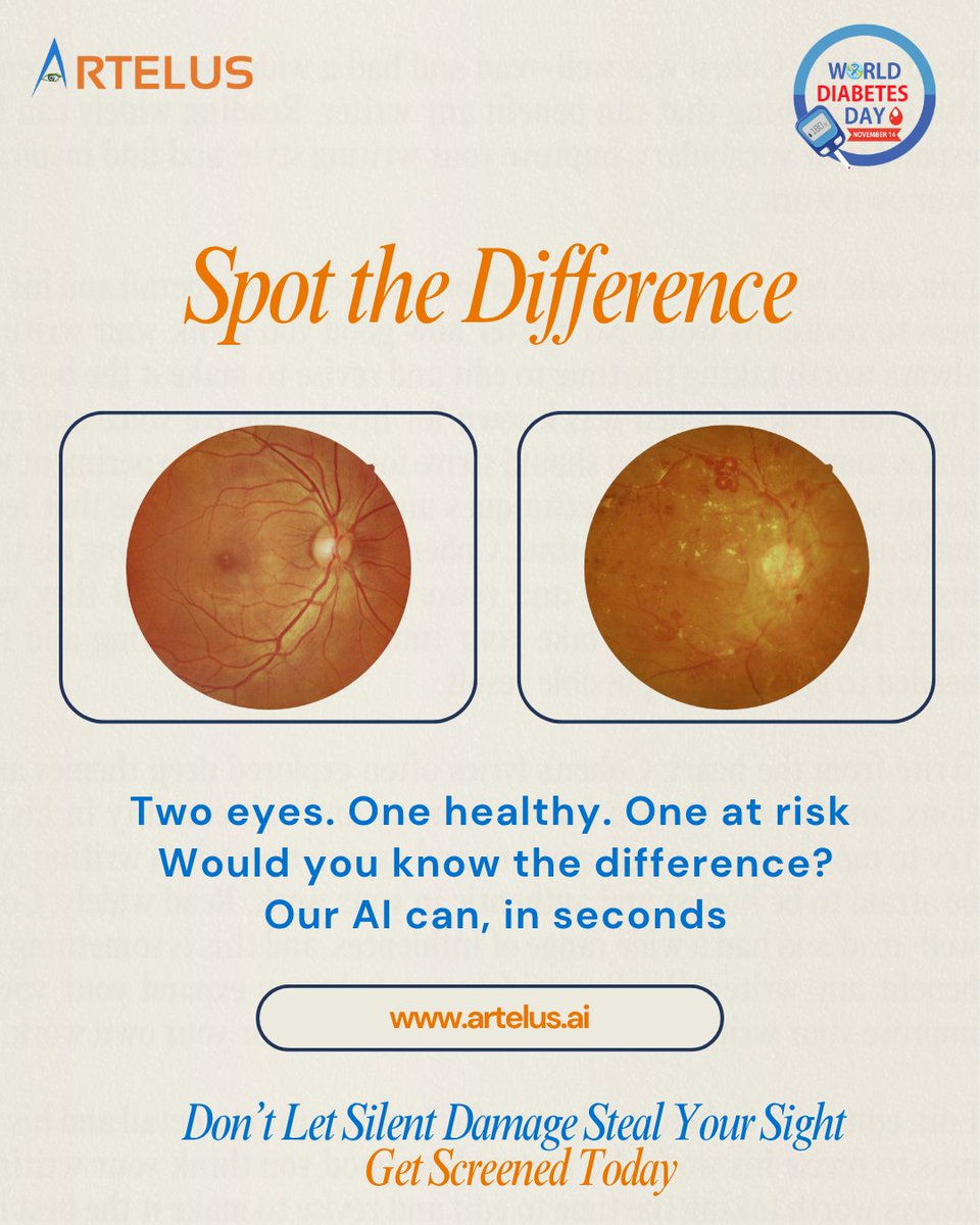 ArtelusAI's tweet photo. 👁️ Two eyes. One healthy. One at risk. Would you know the difference?

Diabetic eye disease can develop silently — but early detection saves sight.

Our AI-powered retinal screening spots signs in seconds.

#WorldDiabetesDay #Artelus #DRISTi #AIHealthcare #DiabeticRetinopathy https://t.co/dsc7k8IPoM