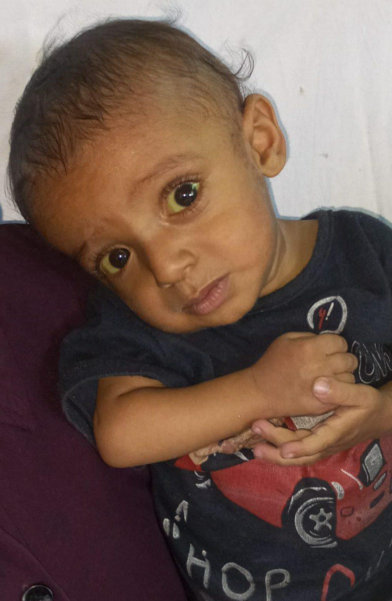 ابنة خالتي تناشد الضمائر الحية لانقاذ طفلها الصغير..

رجاءً لا تمرّوا من هنا مرور الكرام… ضياء يُصارع من أجل الحياة.

وُلد ضياء وهو يُعاني من مرض خطير في الكبد، وتفاقمت حالته حتى أصبح بحاجة ماسة لزراعة كبد عاجلة. كل يوم يمرّ عليه يُهدد حياته أكثر… جسمه الصغير لا يقوى على تحمّل