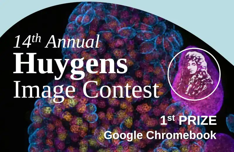 Microscopists! Join in this year's Huygens #Microscopy Image Contest with your most beautiful images and movies and win a laptop or SSD with a microscope image! See this website on how to participate: svi.nl/ImageContest

#ScienceArt #Microscopy #deconvolution #imageanalysis