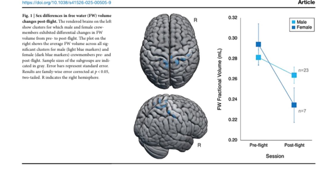 AeroMedicine's tweet photo. Crewmember demographic factors and their association with brain and ocular changes following spaceflight.
—New insights into SANS epidemiology : sex may influence risk, but brain changes appear independent of it.
Via @Nature_NPJ
#SANS #spacemedicine
https://t.co/Tjau9UWzUU https://t.co/rZdQ1Ek6SF