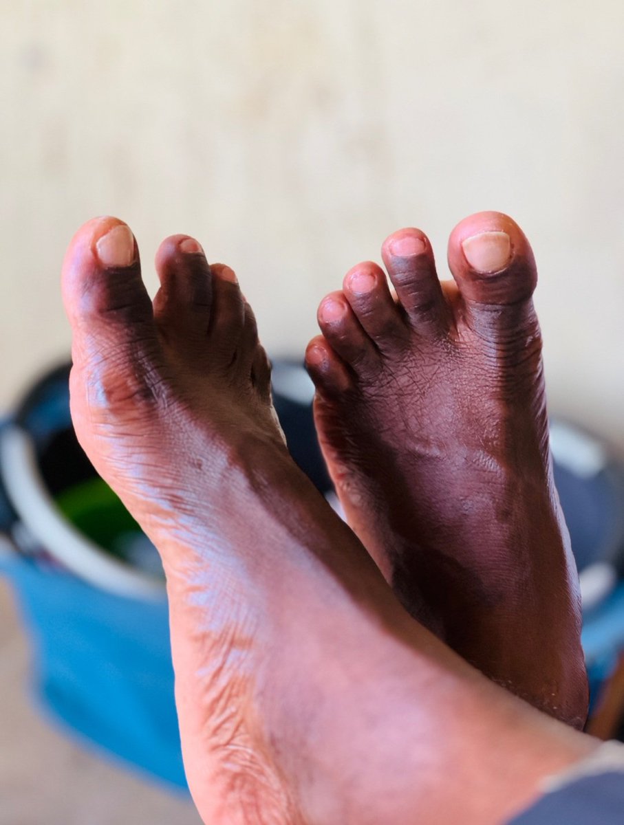 Divinitypearl's tweet image. Pedicure services 
Price -10k per session
Location - mcc owerri imo state