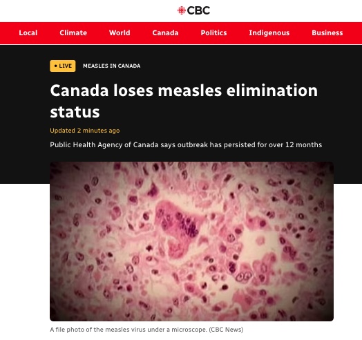 A shameful moment for Canada. 

Anti-vaxxers misinformed and specific communities fuelled measles spread. 

If only there was a cheap, effective, proven and safe strategy which lead Canada to first eliminate measles in 1998. There is. It's the vaccine. 

cbc.ca/news/health/li…