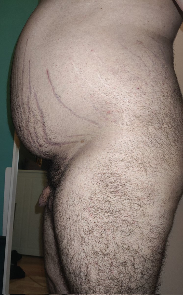 Last night was incredible, got encouraged by many blimps on a server to pump till I pop. 🤤🥵 Their genuine enthusiasm to push me bigger and rounder got the best of me and I did end massive, ready to blow loud! 🎈💥

#Bellykink #Bellyinflation #Bellyexpansion #Malebellyinflation