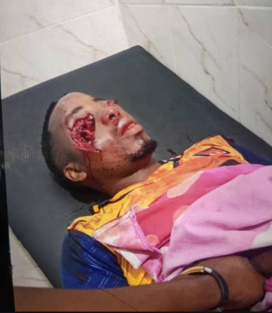 MariaSTsehai's tweet image. Hey  Suluhu aplogists!
Economic terrorists my foot! This is wanton violence and massacre against innocent people
Omar Idd Korombo was AT HOME not protesting and today he is dead - viciously killed! 
What demonic stuff is this? Why would @SuluhuSamia ‘s mercernaries go into Omar…