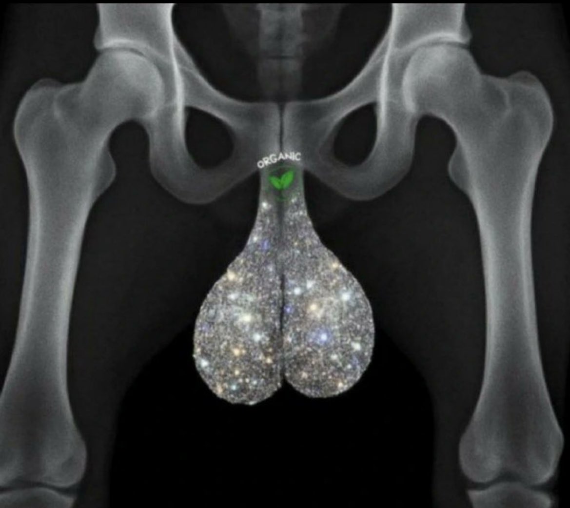 After years of red candles and FUD, this is what conviction looks like under an X-ray.

You can’t teach this level of patience… it’s forged through every dip.

Lock in 🫡