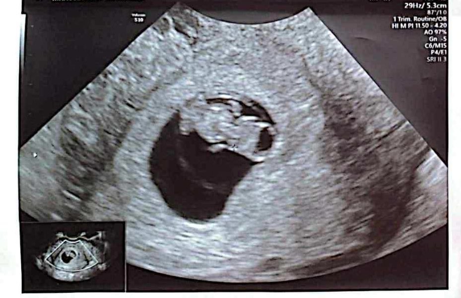 NiteRAId tweet media