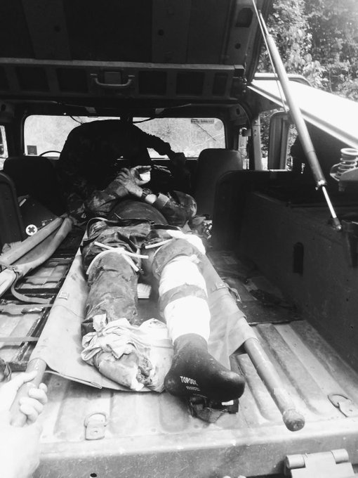 ต้องสูญเสียเท่าไร.... โดนอีกแล้ว #ชายแดนไทยกัมพูชา #เหยียบระเบิด #ทหารไทย วันนี้ 10 พ.ย.68