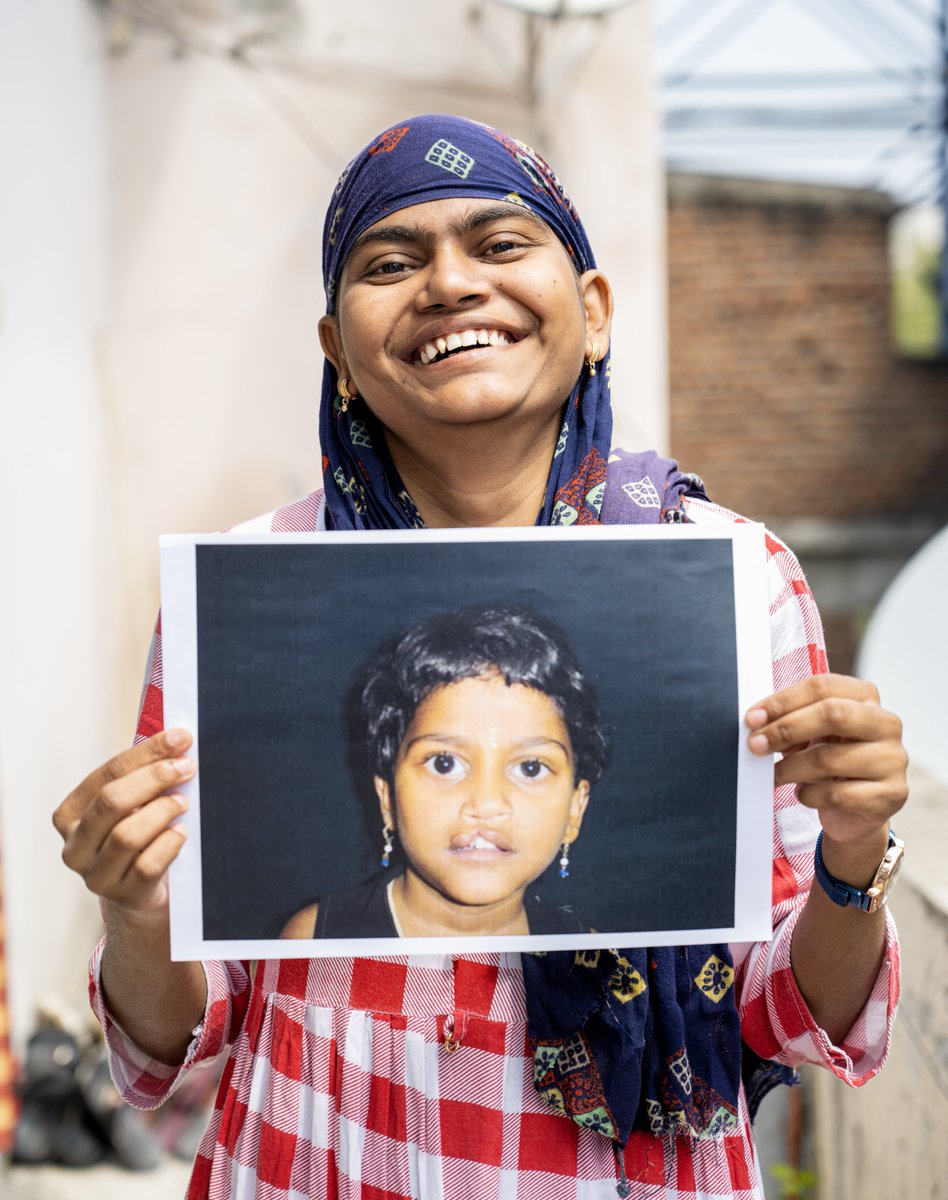 #DidYouKnow with 750,000+ cleft surgeries delivered in the past 24+ years, #SmileTrain has already transformed thousands of lives in India? 
The credit largely goes to our partner doctors who not only believe in our goals but live them with passion and commitment. 

#SmileTrain