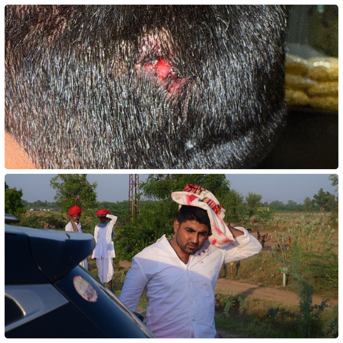 पाली से न्याय की आवाज़

बालराई में राष्ट्रीय पशुपालक संघ व DNT संघर्ष समिति के शांतिपूर्ण प्रदर्शन पर लाठीचार्ज कर NSUI महासचिव ओम सिंह देवासी को गंभीर चोट पहुँचना और उन पर राजकार्य में बाधा का मुकदमा दर्ज करना लोकतांत्रिक अधिकारों का दमन है।

हम सरकार से मांग करते हैं —
👉 ओम