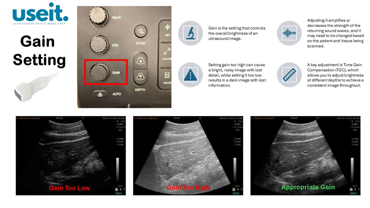 pocus_today's tweet image. #useit #POCUS  Gain Setting &amp;amp; TGC. Basic ultrasound knobology to optimise your images.

Image Source: eimedical.com/blog/understan…