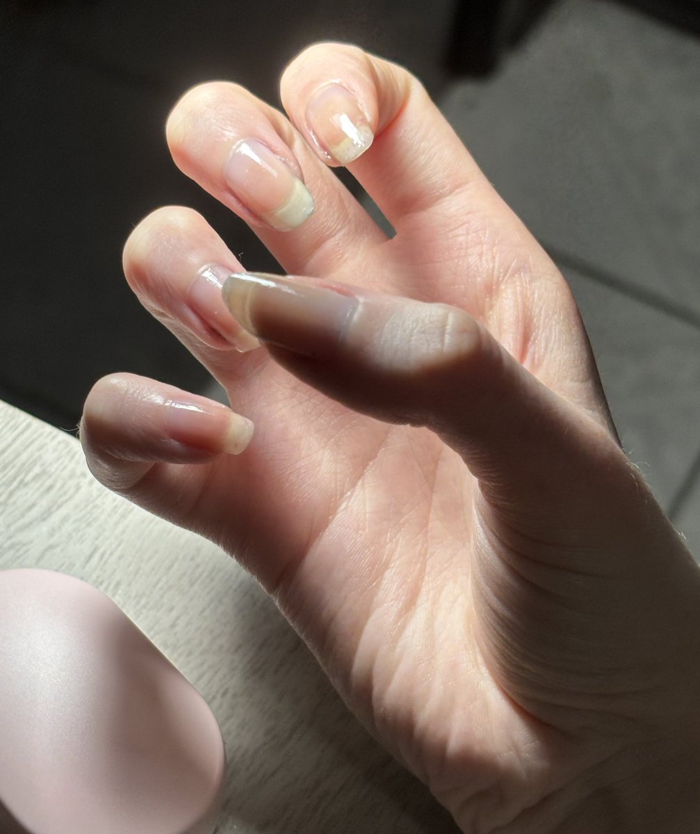 rafefvs's tweet image. nao  sei  lixar  as  unhas  e  estraguei  tudo  😤😤😤