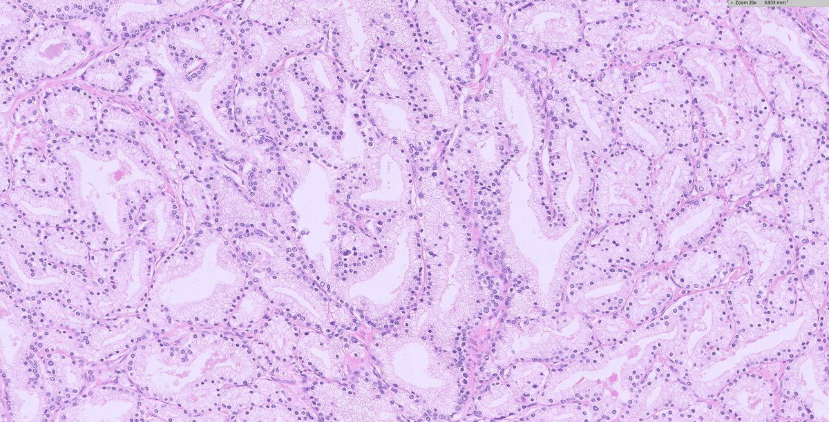 Lorand Kis tweet media