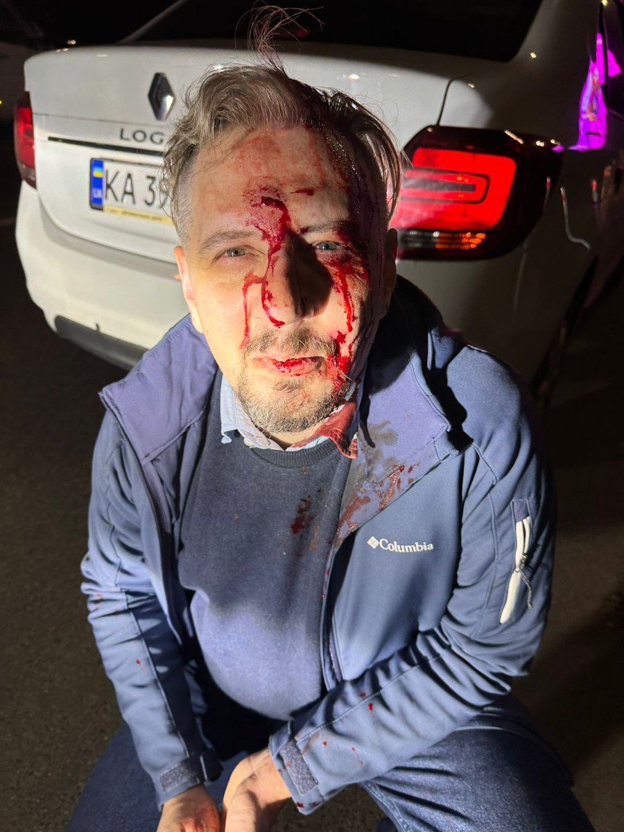 Leonidium's tweet image. В п&apos;ятницю, 14 Листопада, на мене напав водій що їхав позаду. Це було о 19:30 на другорядній дорозі Голосіївського проспекту, в напрямку до Виставкового центру. Трохи не доїхавши до АТБ.
Пишіть, хто бачив цю ситуацію, бо треба свідки і факти.
Репост.