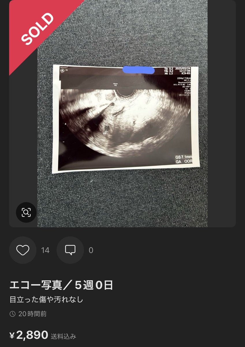 mercari_rabbit's tweet photo. 「 あなたの子を妊娠した。堕胎するための費用を払って 」

マッチングアプリを利用して男から中絶費用を受け取る" 妊娠詐欺 "が横行

きのう8/25,メルカリは9/1以降に【エコー写真】を削除すると発表した

「ひと月に複数人から100万円近く稼いだ」という女性まで…

結局メルカリは抜け穴があって、 https://t.co/AyTdZeKnCg