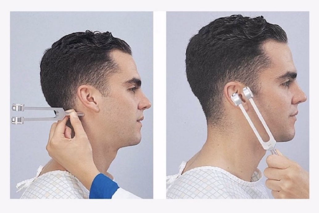 drkeithsiau's tweet image. What is the name of this test?