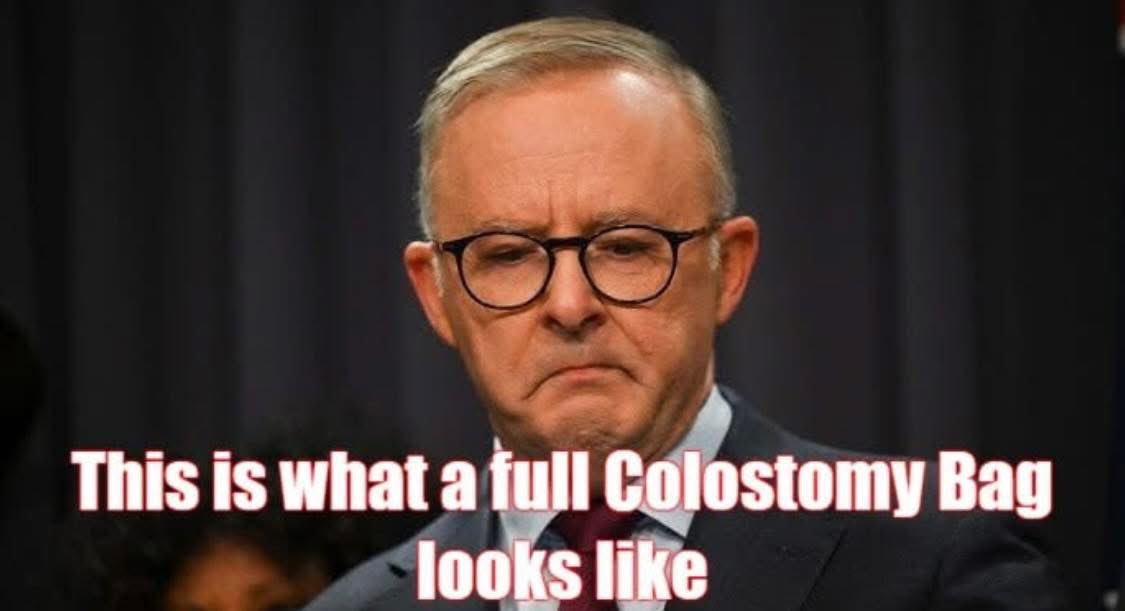Joey1800callme's tweet image. AUSTRALIAN PUBLIC SERVANTS TAKING THE PISS #2

Anthony Albanese, current PM….

Total annual cost to taxpayers = $6.5-7 million (salary @ $622k &amp;amp; all expenses)

Annual Cost vs “Benefit”?

$7M vs The most divisive PM &amp;amp; highest cost of living in Aussie History