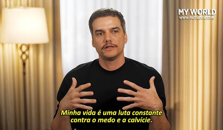 não aceitem a calvície msm