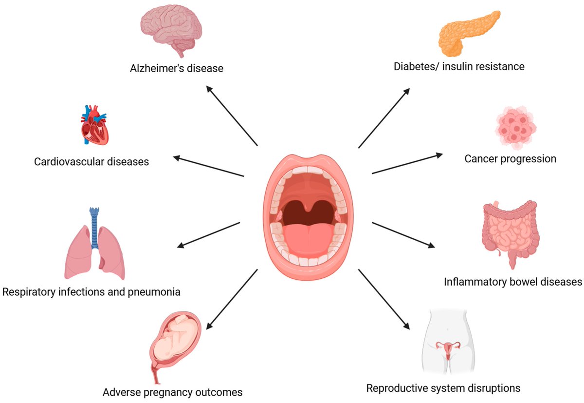 Micro_MDPI's tweet image. 🦷💥 This review explores how inflammatory oral–systemic interactions may influence female reproductive health and pregnancy outcomes.

🔗 mdpi.com/2076-2607/13/3…

#OralMicrobiome #Dysbiosis #Infertility #PCOS #Endometriosis #WomenHealth #ReproductiveHealth