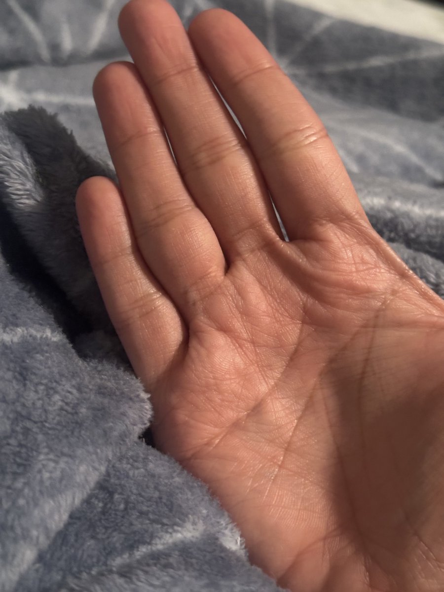 Does anyone else have finger gaps? I just started to notice mine