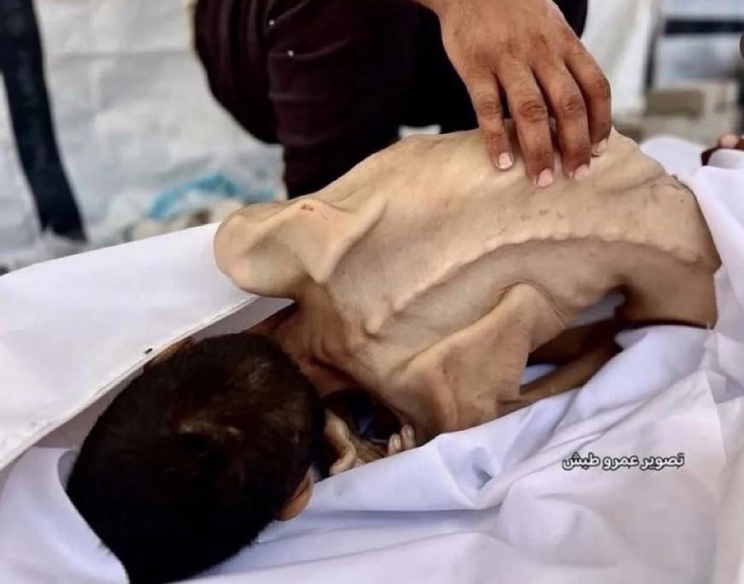 ShaykhSulaiman's tweet image. He was starved to death in Gaza by lSRAEL