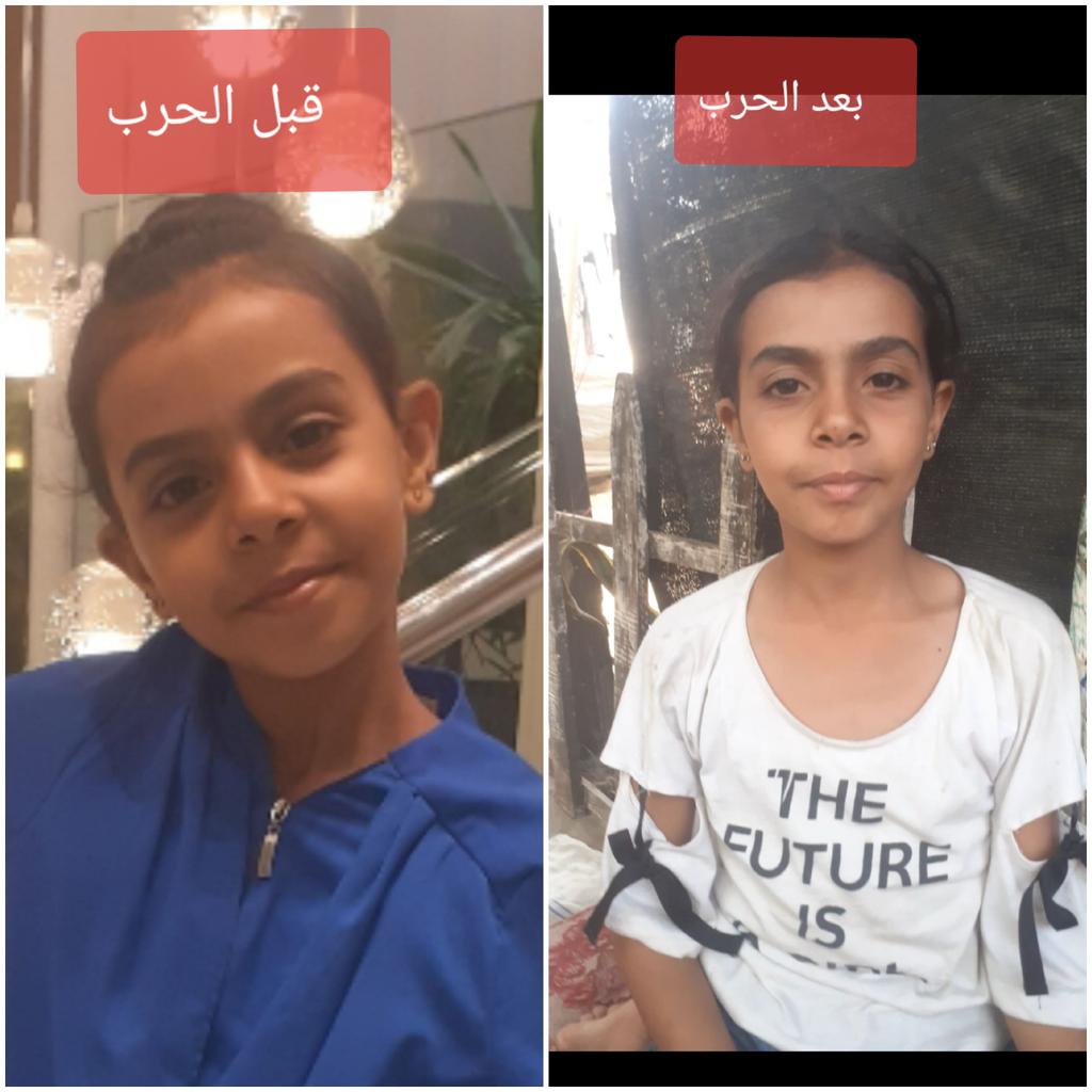 Have mercy on the features of our children, which have turned from innocence to old age. They were burdened with a responsibility beyond their capacity. Support them to help alleviate their pain.
<a href="/Emathyst9/">Em/Will 🍉🌻 #1 William Afton fan | fandom account</a> 
<a href="/Staticulator/">Static-kun</a>
chuffed.org/project/138119…