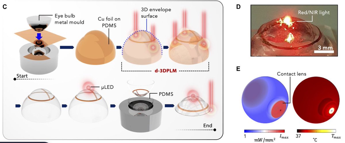 BioelDrop's tweet image. Pulsed laser microfabrication for 3D #bioelectronics 💥
Lithography is limited to 2D patterning. Scientists at @UniofOxford led by @Max_Mariello and @DrSeeProctor propose an approach applicable to nonplanar and soft substrates👀

@ScienceAdvances science.org/doi/10.1126/sc…
